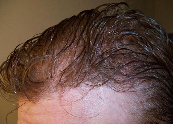 Prótese masculina (cabelo humano)