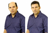 Prótese masculina (cabelo humano)